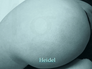 Heidel